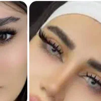 کاشت مژه هیدن دو‌لاین ۲۵۰