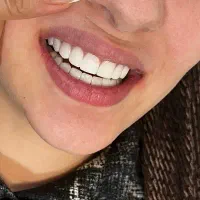 آموزش دندانپزشکی