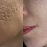 پودر کلاژن همراه کرم ترمیم کننده