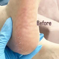 کف سابی و اسپا (پا)