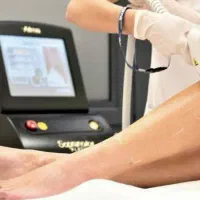 لیزر مو تیتانیوم کوهرنت آمریکا در مرکز ice laser