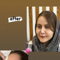 تزریق چربی به تمام نواحی|خدمات آرایشگری و زیبایی|قزوین, |دیوار