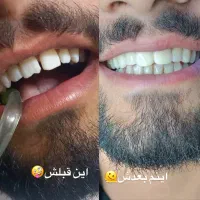 جشنواره دندانپزشکی.آموزش و زیبایی و درمانی|خدمات آرایشگری و زیبایی|اهواز, کیانپارس |دیوار