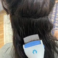 پاکسازی شپش و رشک بایک جلسه تضمینی توس33