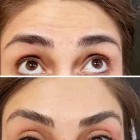 اف بوتاکس ۸۰۰
