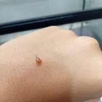 چند عدد بچه حلزون