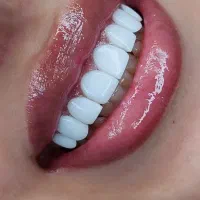 شرایط ویژه کامپوزیت و خدمات دندانپزشکی