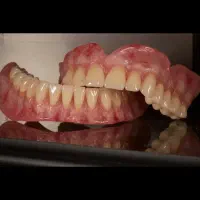 ساخت انواع دندان مصنوعی