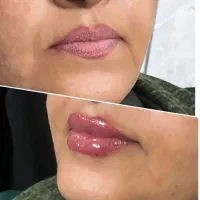تخفیف آموزشی‌ و خدمات فوق العاده کلیه لاین زیبایی