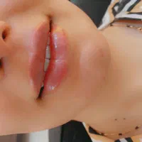 تزریق ژل و بوتاکس،فیلر بدن و لیفت با نخ|خدمات آرایشگری و زیبایی|کیش, |دیوار