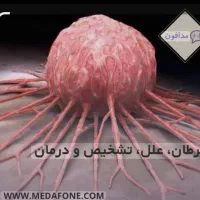 راهنمایی درباره بیماری سرطان
