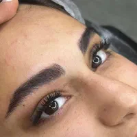 میکروبلیدینگ فیبروز‌ شیدینگ‌لب بن مژه