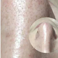 تخفیف یلدایی پاکسازی پوست فقط ۵۰۰تومن|خدمات آرایشگری و زیبایی|محمدیه-قزوین, |دیوار