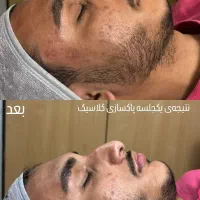 فیشال و پاکسازی تخصصی و کلینیکال پوست آقایان|خدمات آرایشگری و زیبایی|شیراز, قدوسی شرقی|دیوار