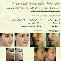 جشنواره تخفیف ویژه تابستانی  پاکسازی تخصص پوست