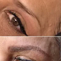 میکروبلیدینگ