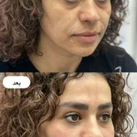 خدمات ژل وبوتاکس /کاشت مووابرو/باکمترین قیمت|خدمات آرایشگری و زیبایی|خرم‌آباد, |دیوار