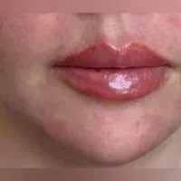 خدمات زیبایی ژل و بوتاکس|خدمات آرایشگری و زیبایی|اردبیل, |دیوار