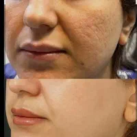 آراف فرکشنال منافذباز و جای اسکار