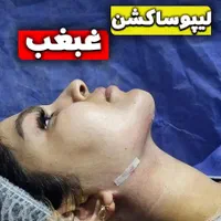 ساکشن کل بدن توسط پزشک