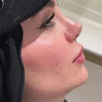 جراحی عمل بینی/لیپو/ابدو/بلفارو