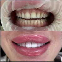 سلامت و زیبایی دندان|خدمات آرایشگری و زیبایی|رشت, گلسار|دیوار