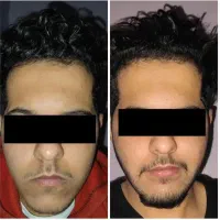 معجزه قرن