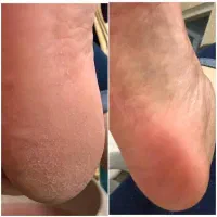 off کاشت ناخن دست و پا و کفسابی کف پا|خدمات آرایشگری و زیبایی|نجفآباد, هفده شهریور|دیوار