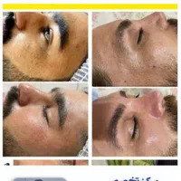 پاکسازی تخصصی پوست آقایان (کاشمر)|خدمات آرایشگری و زیبایی|کاشمر, |دیوار