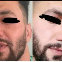 سرم|آرایشی، بهداشتی، درمانی|کارون, |دیوار