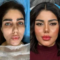 پایان جستجو کلینیک تخصصی پوست نخ هایفو آموزش ژل|خدمات آرایشگری و زیبایی|تهران, زعفرانیه|دیوار