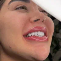 ارتودنسی.روکش.کامپوزیت.لمینت.عصب کشی