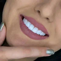کامپوزیت دندان و روکش سرامیک دندان ایمپلنت|خدمات آرایشگری و زیبایی|تهران, صادقیه|دیوار