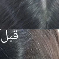 پاکسازی شپش باموادصددرصد گیاهی و تضمینی