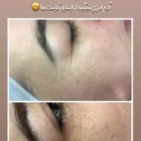 پاکسازی پوست ، ژل و بوتاکس در کلینیک زیبایی|خدمات آرایشگری و زیبایی|اهواز, پادادشهر|دیوار