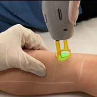 کلینیک لیزر نسیم شعبه غرب تهران