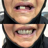 کلنیک دندانپزشکی ودندانسازی، دندان مصنوعی|خدمات آرایشگری و زیبایی|شیراز, سیاه سنگ|دیوار