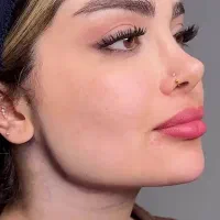 بوتاکس فیلر لیفت با نخ زیبایی لیزر دکتر محکی