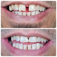 دندانپزشکی اقساطی با اسنپ پی