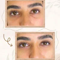 تزریق فیلر و بوتاکس توسط پزشک با تخفیف ویژه|خدمات آرایشگری و زیبایی|اراک, |دیوار