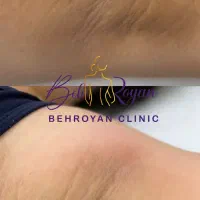 سفیدی بدن و صورت کیلینیک به رویان