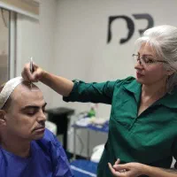 کاشت مو به روش شیرازی|خدمات آرایشگری و زیبایی|قم, زنبیل آباد|دیوار