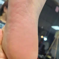 آموزش و خدمات پدیکور تخصصی به سبک روسی|خدمات آرایشگری و زیبایی|خوی, |دیوار