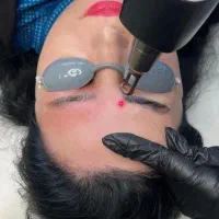 ریمو تتو در دورود