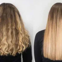 گلوبال و درمان ریزش مو