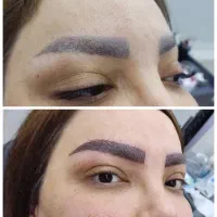 میکروبلیدینگ وقاب سایه