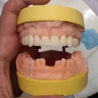 دندانسازی تاکستان|پزشکی|تاکستان, |دیوار