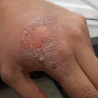 کلینیک تخصصی زخم|خدمات آرایشگری و زیبایی|فولادشهر, B2|دیوار