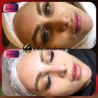 آموزش پوست شیشه ای( مجازی) محو پیسی|خدمات آموزشی|تهران, امیرآباد|دیوار