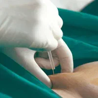 کاشت نخ لاغری امبدینگ